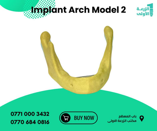 Implant arch 2